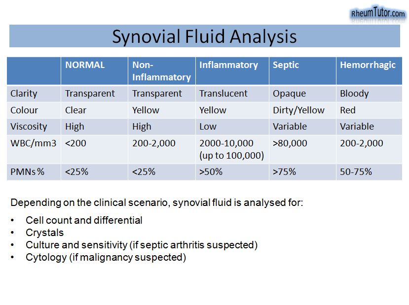 Synovial Fluid Analysis · RheumTutor